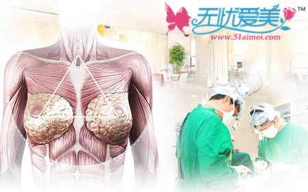 韩国MD整形医院胸部手术